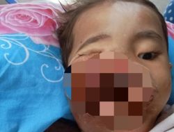 Rafka Rafardhan Bocah Usia 3 Tahun Derita Tumor Ganas di Batu Bara Butuh Uluran Tangan
