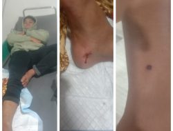 Polres Simalungun Bekuk Pelaku Penembakan Massal Yang Mengakibatkan 5 Luka Luka di Perumahan Rorinata Kelurahan Sondi Raya